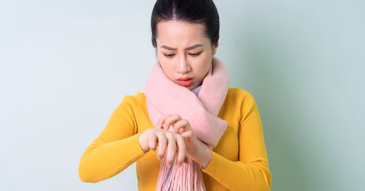 สาเหตุ อาการ การรักษาลมพิษ - Urticaria (Hives): Causes, Symptoms, Treatments