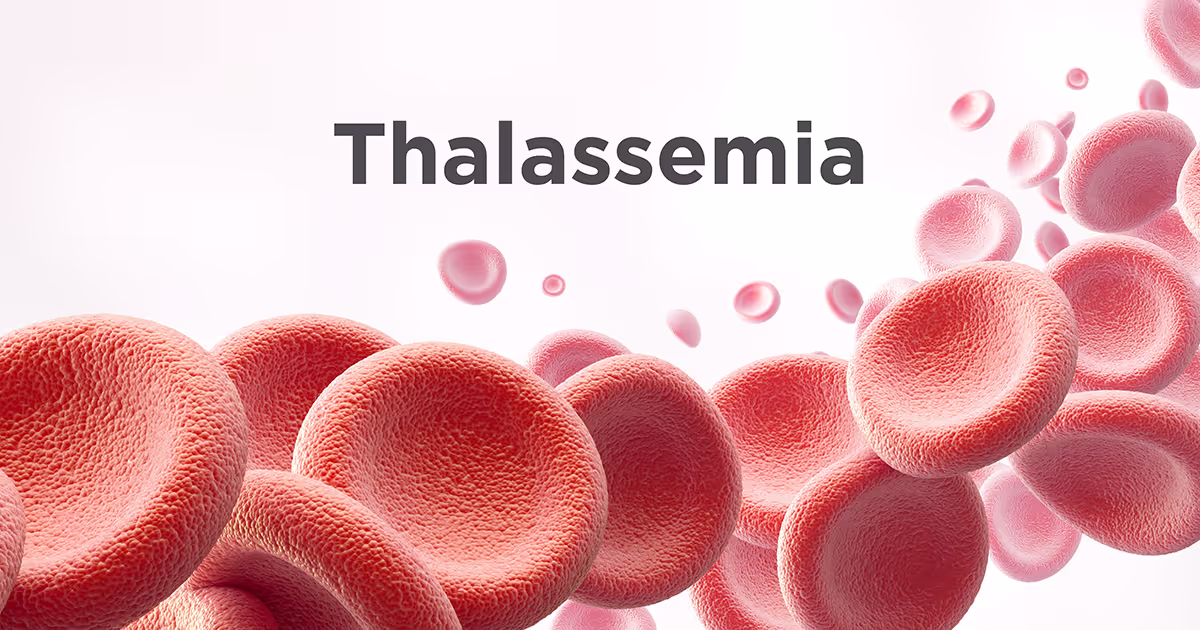 สาเหตุ อาการ การรักษาธาลัสซีเมีย (Thalassemia) - Causes, Symptoms, and Treatments of Thalassemia 