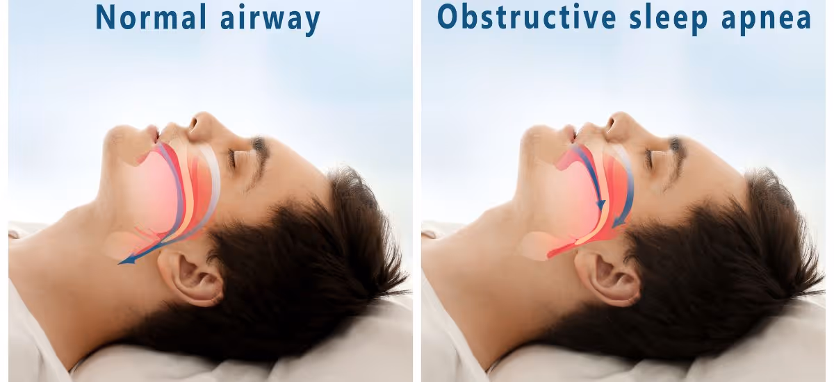 Sleep Test Banner 4