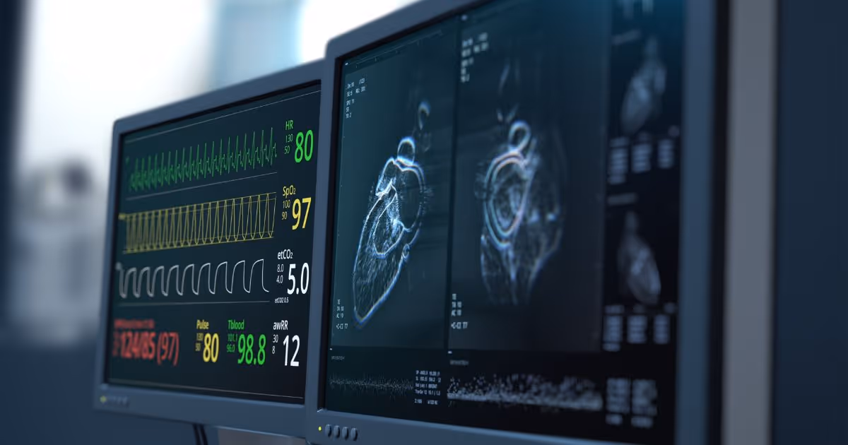 การวินิจฉัยด้วยการตรวจ MRI หัวใจ - Cardiac MRI diagnosis