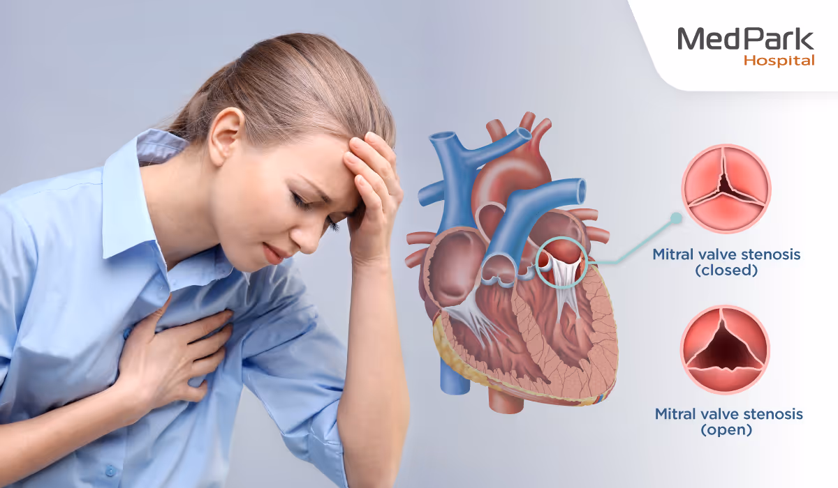 What Disease Does Mitral Valve Repair Treat En