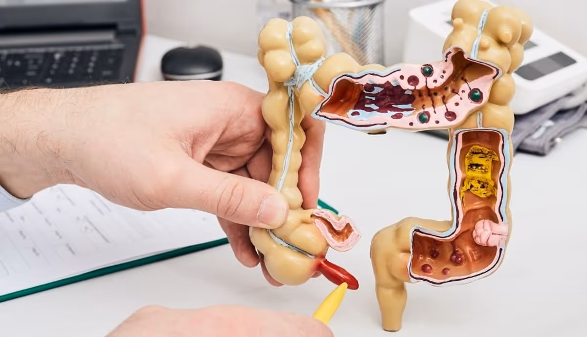 ไส้ติ่งอักเสบ มีวิธีีการวินิจฉัยอย่างไร