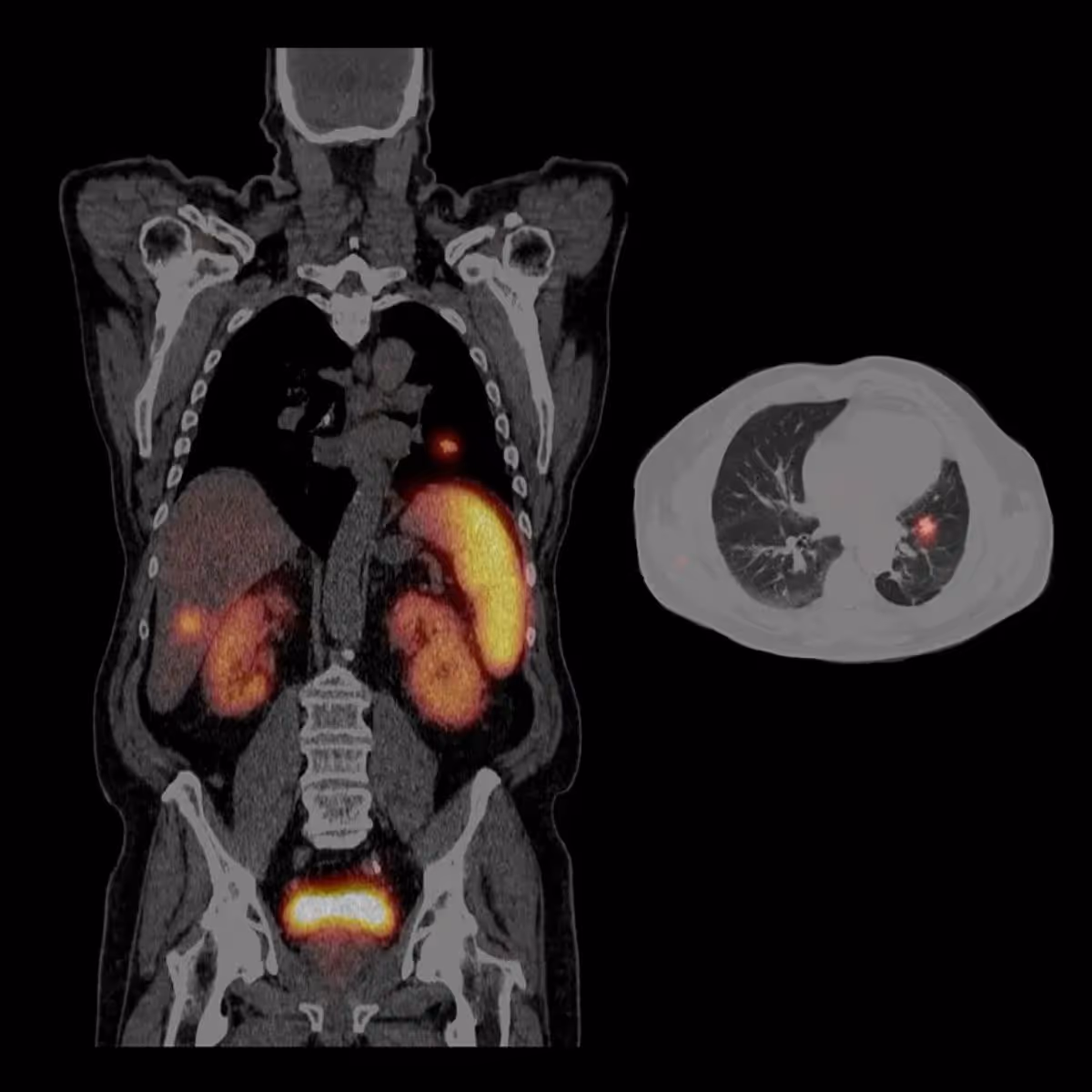Symbia Intevo Spect Ct