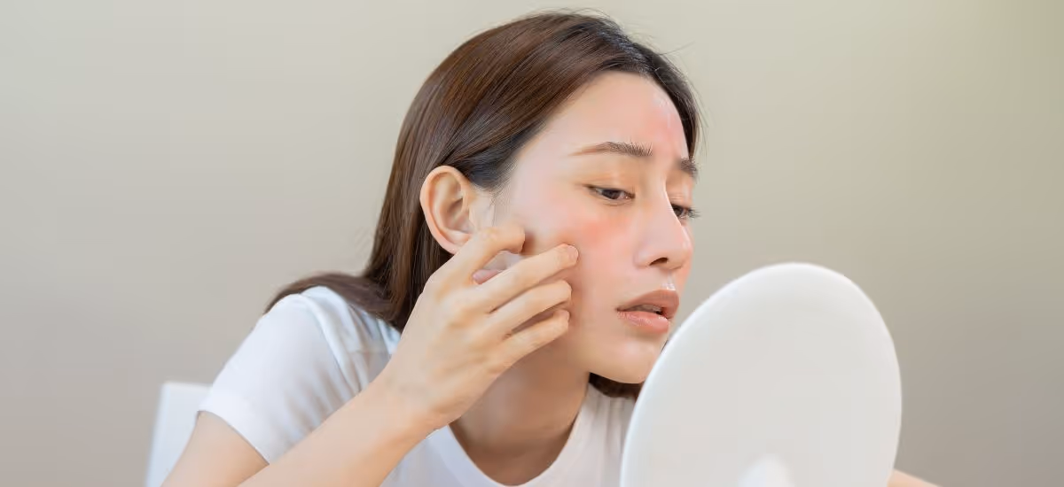 Cosmetic Expire  Banner 2
