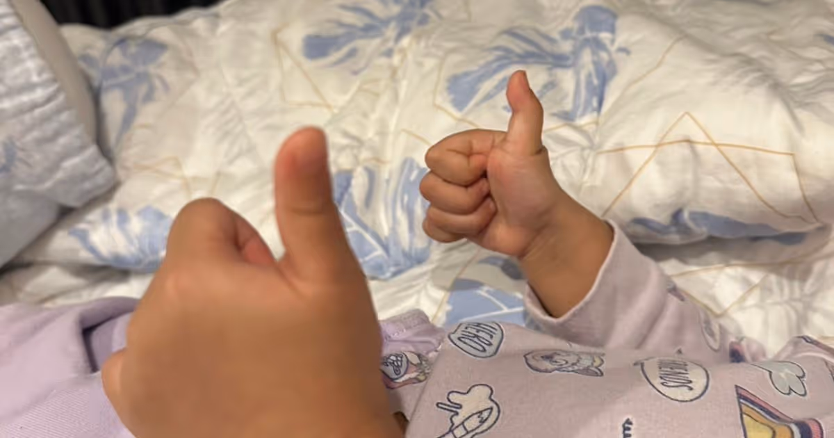 Trigger Finger in Children Review 2