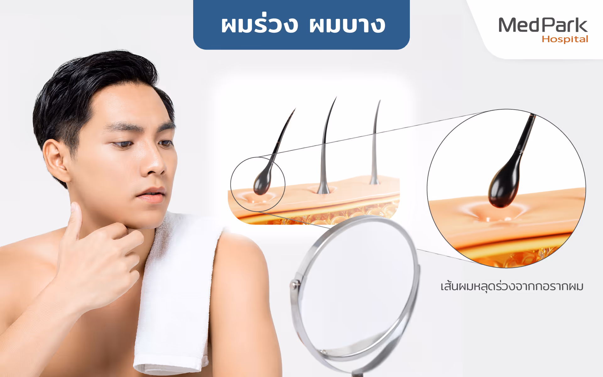 FUE รักษาอะไร