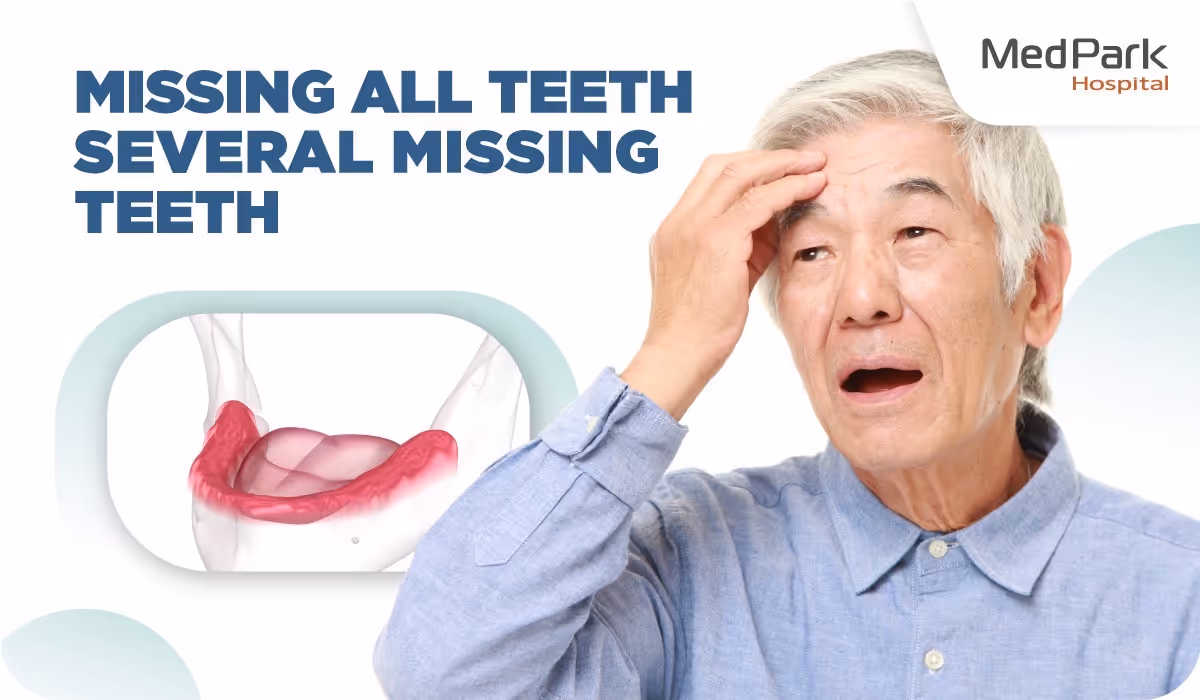 Why All on 4 Dental Implants?