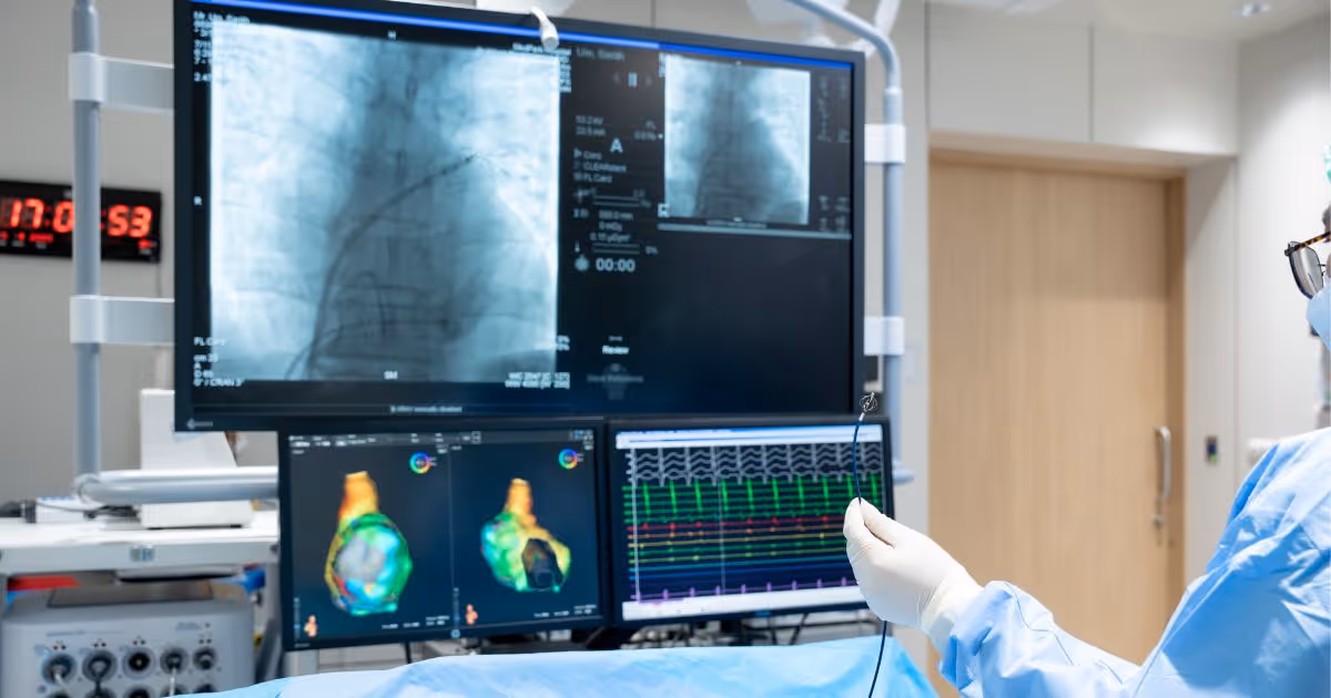 The benefits and risks of PCI