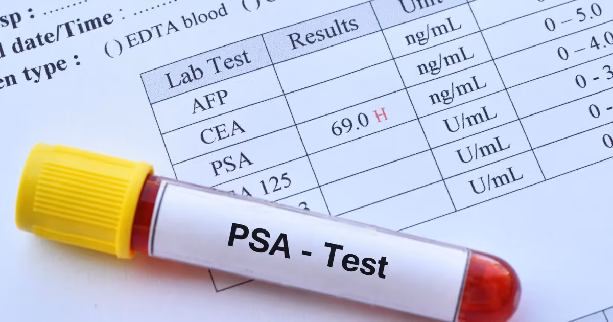 Psa Tests 2
