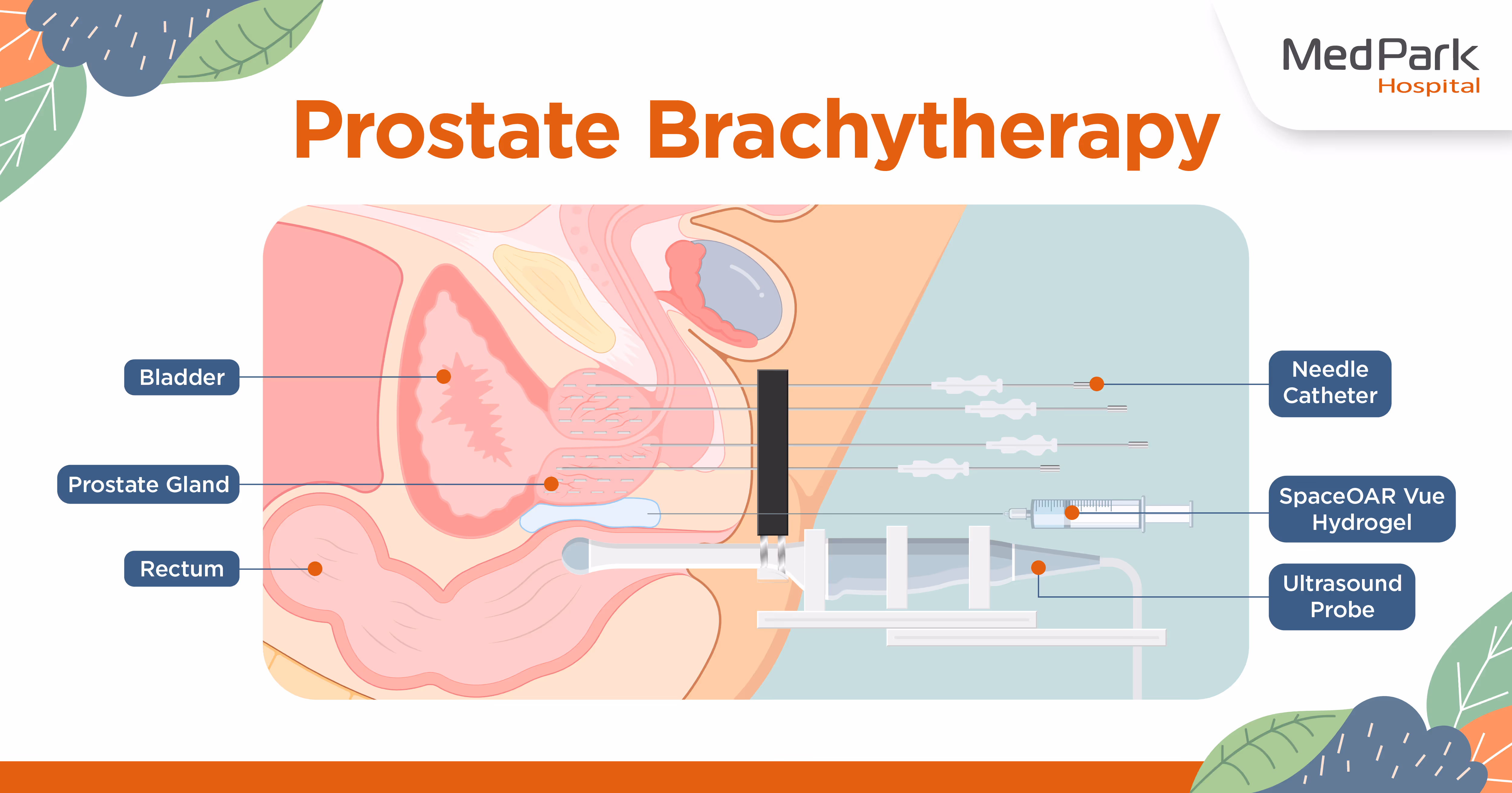 How Is Brachytherapy Performed?