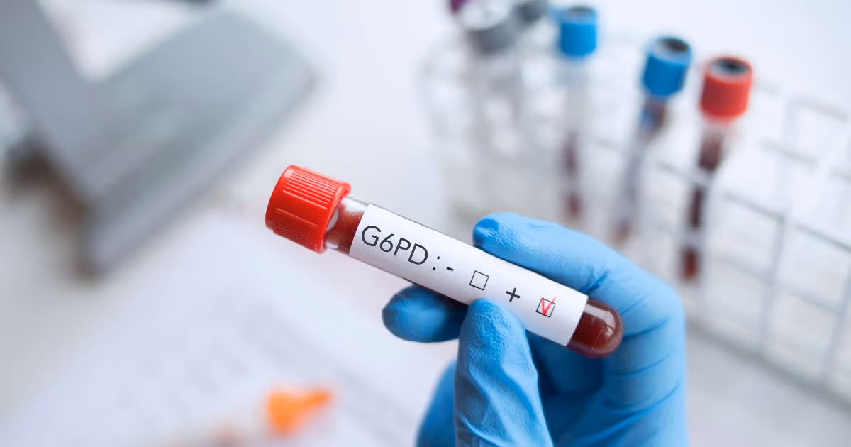  G6PD มีวิธีการตรวจวินิจฉัยอย่างไร-How is G6PD diagnosed