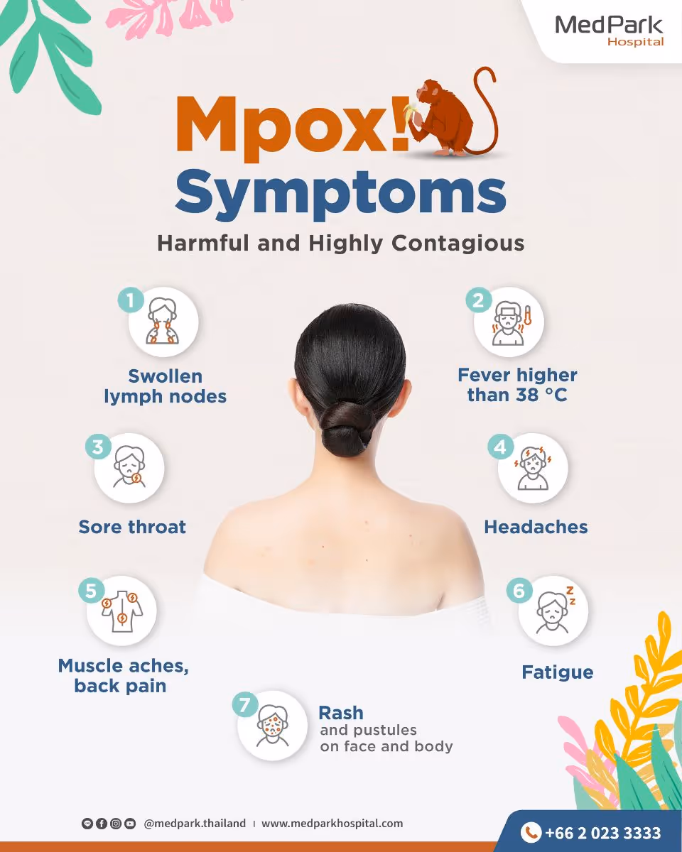 Monkeypox   Infographic En