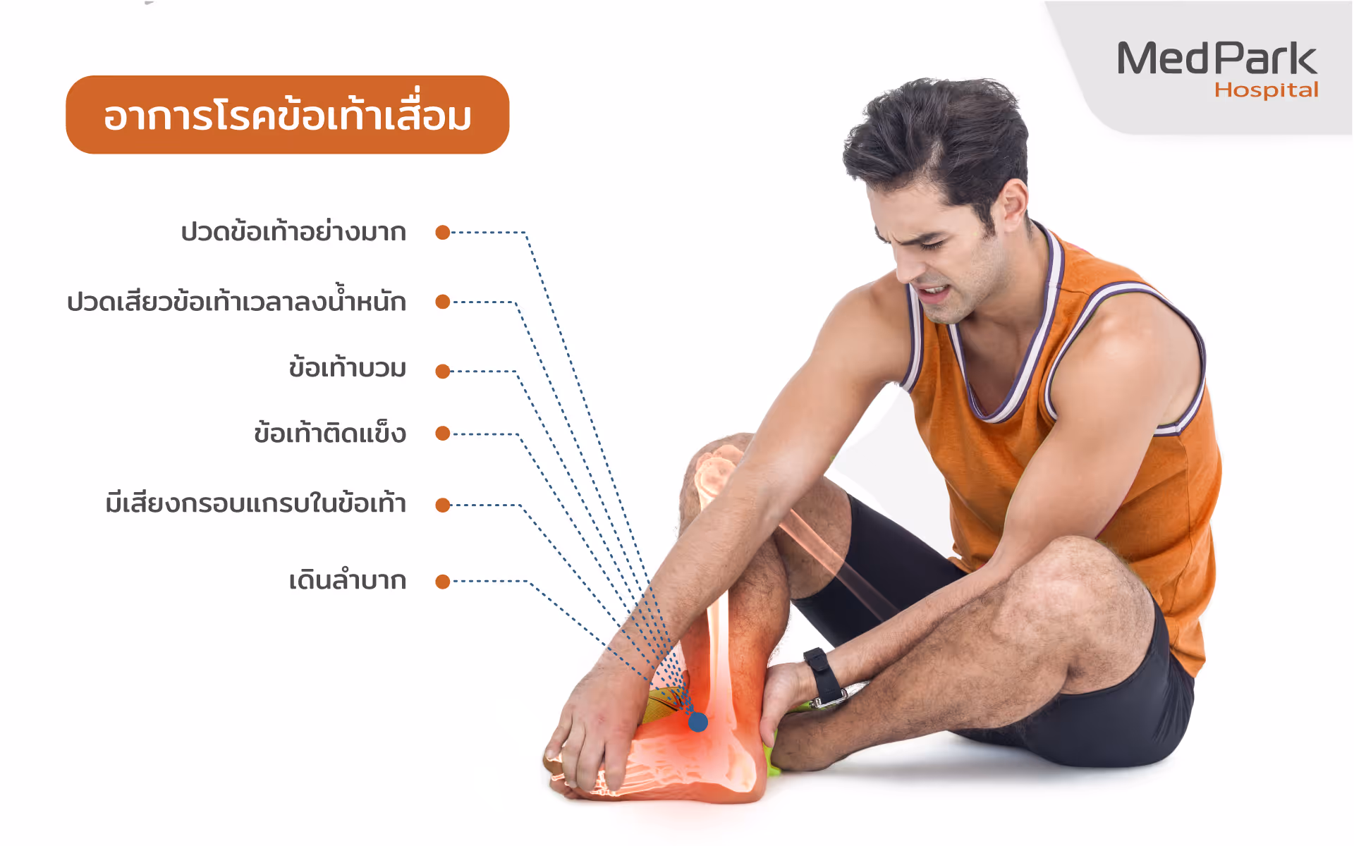 ข้อบ่งชี้ การผ่าตัดเปลี่ยนข้อเท้าเทียม