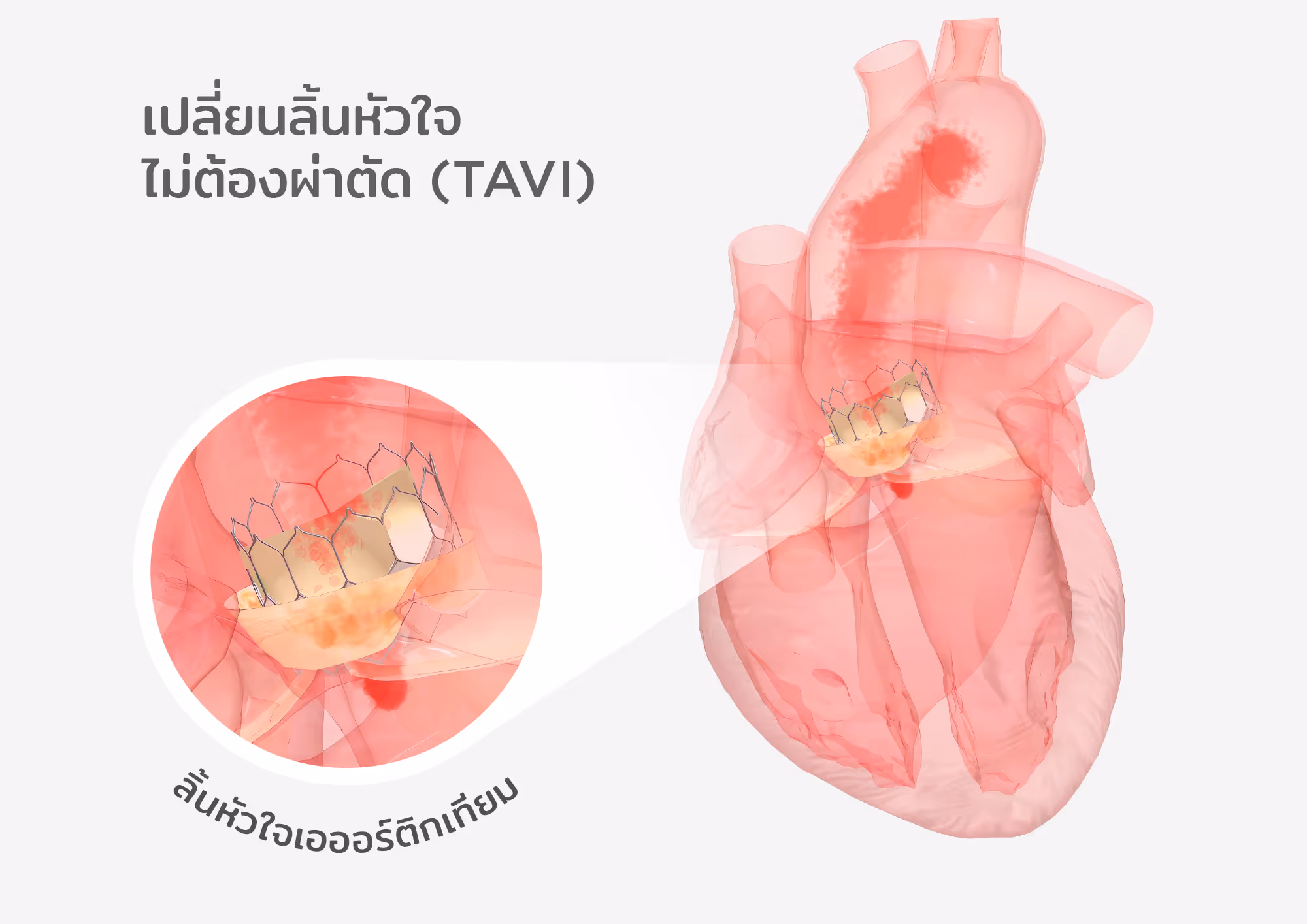 241227 Aw ประกอบบทความ เรื่อง Tavi 1