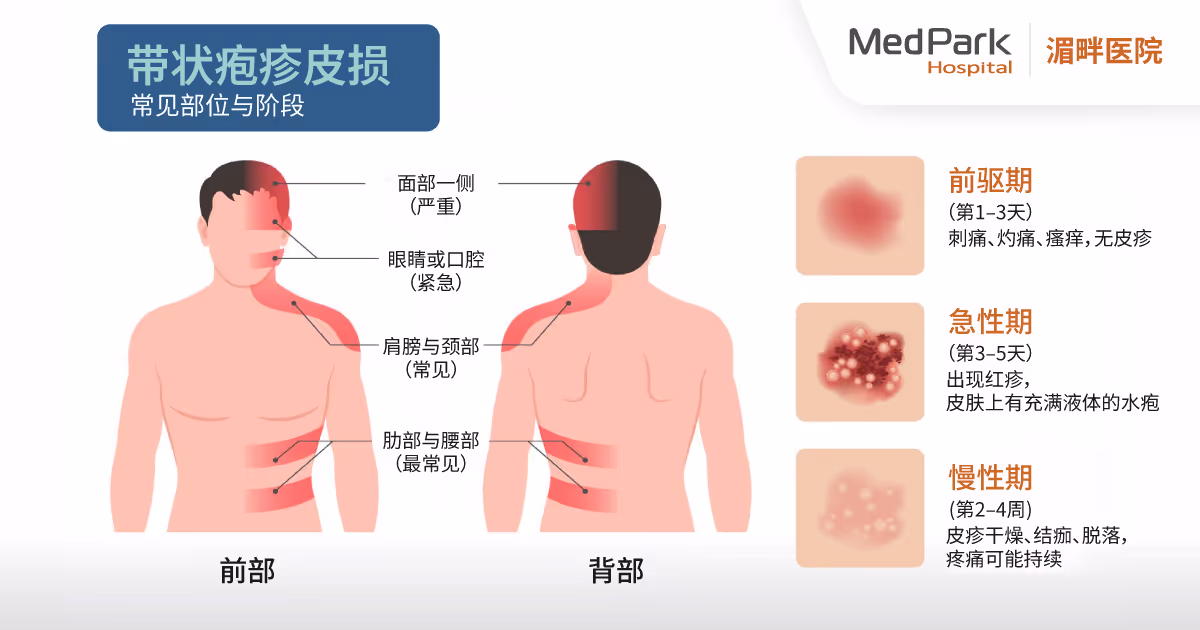 D46 Bff E2 11 C7 4 E62 94 Ae 6 C8 B7 E7642 Ce