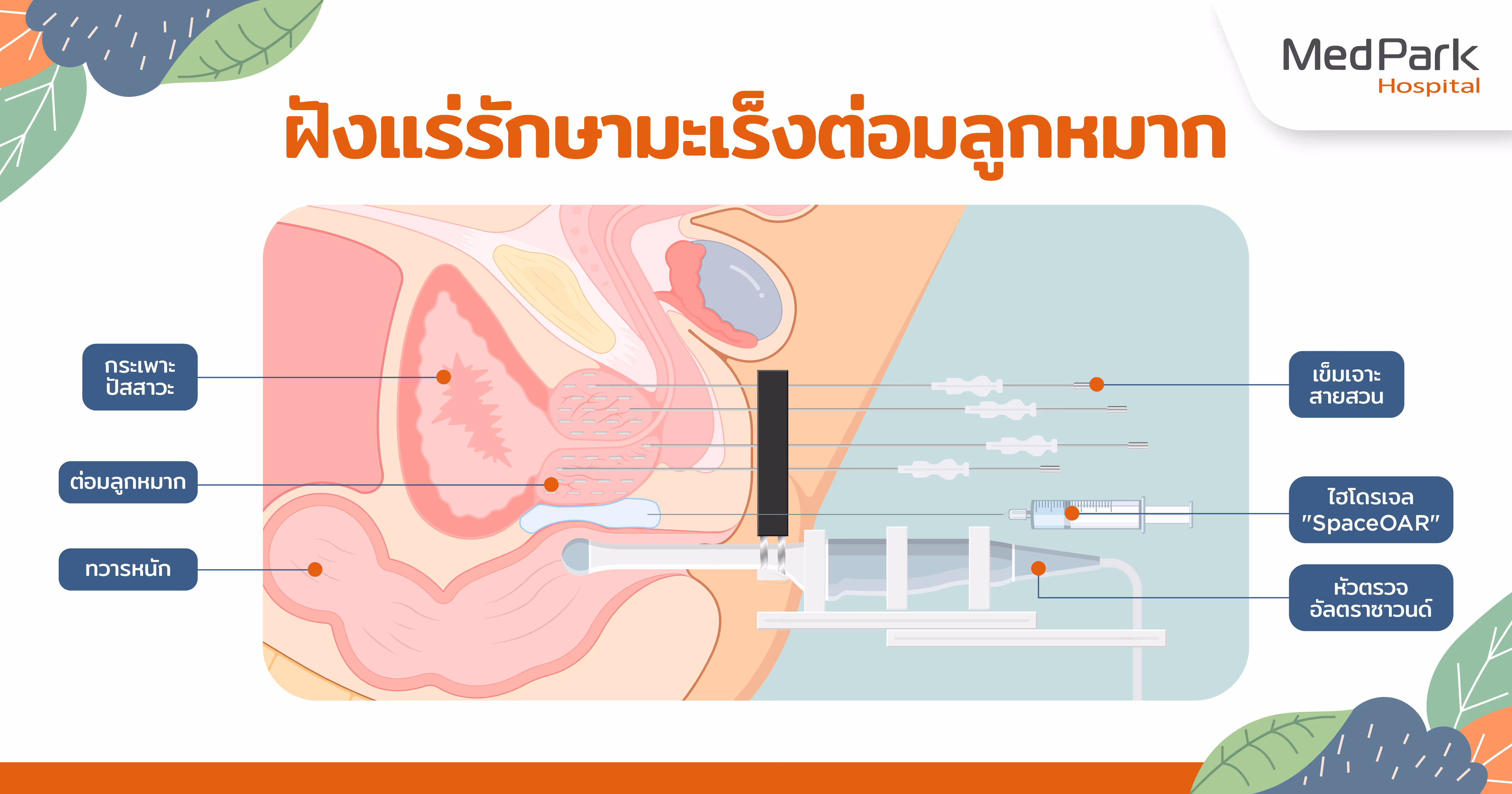 การใส่แร่กัมมันตรังสี ทำอย่างไร