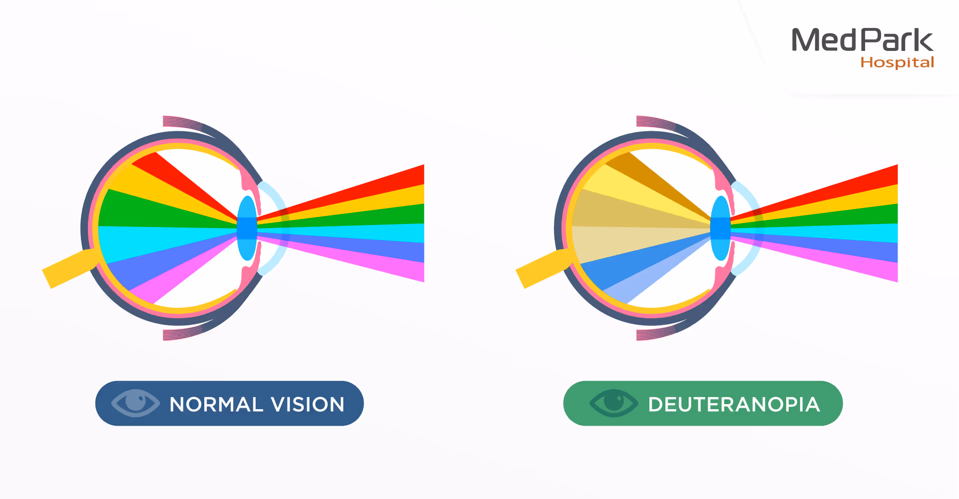 Aw ภาพประกอบบทความ ตาบอดสี 01 (1) 0