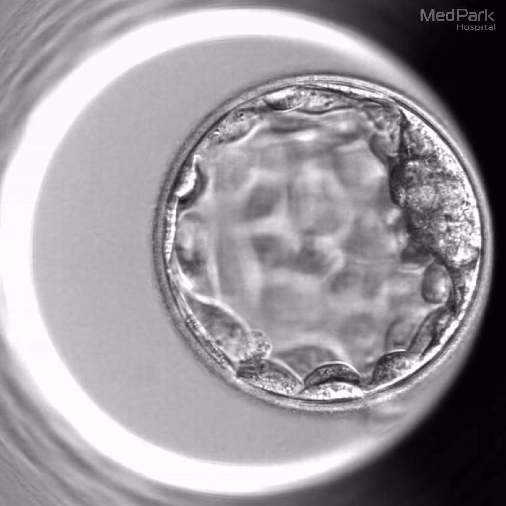 Ivf Embryo Grading Banner 4