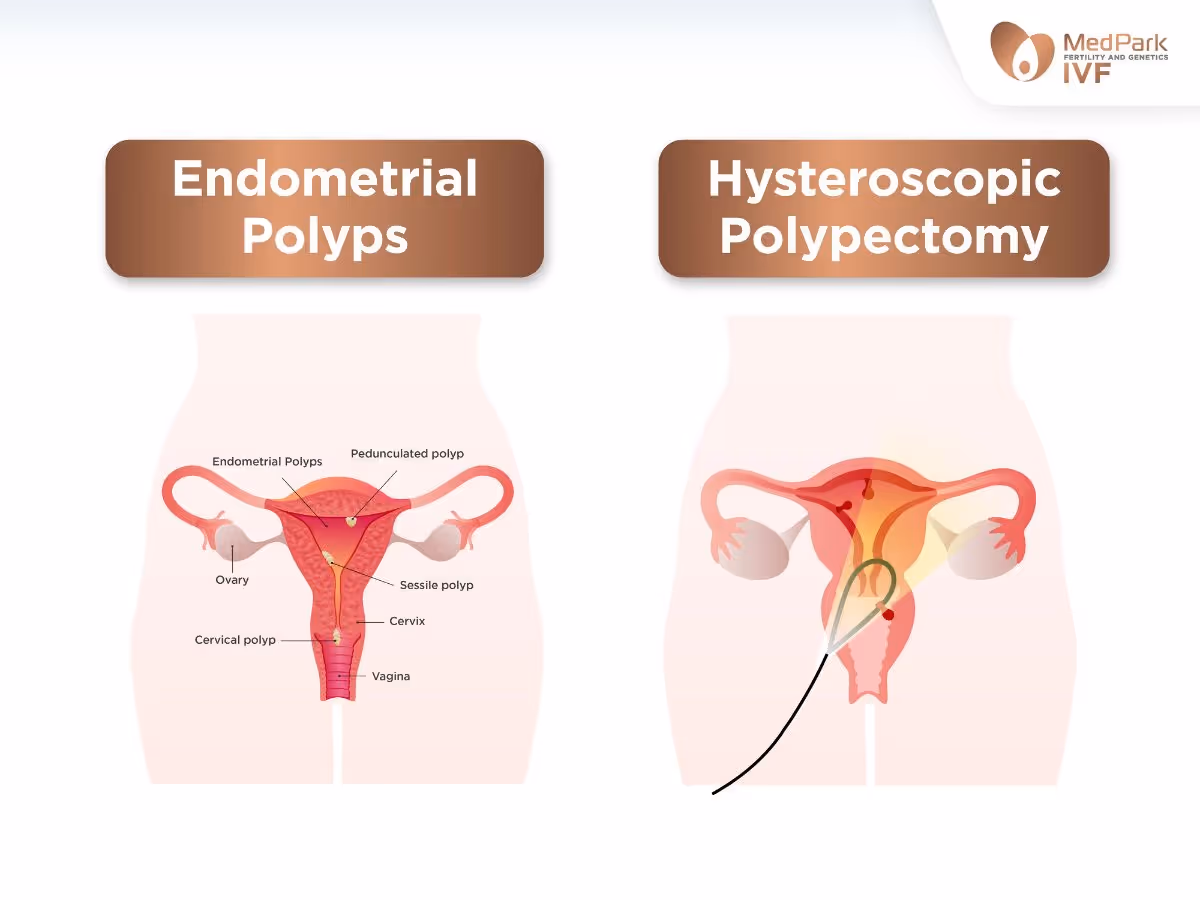 Diagnostic hysteroscopy investigates uterine diseases and abnormalities