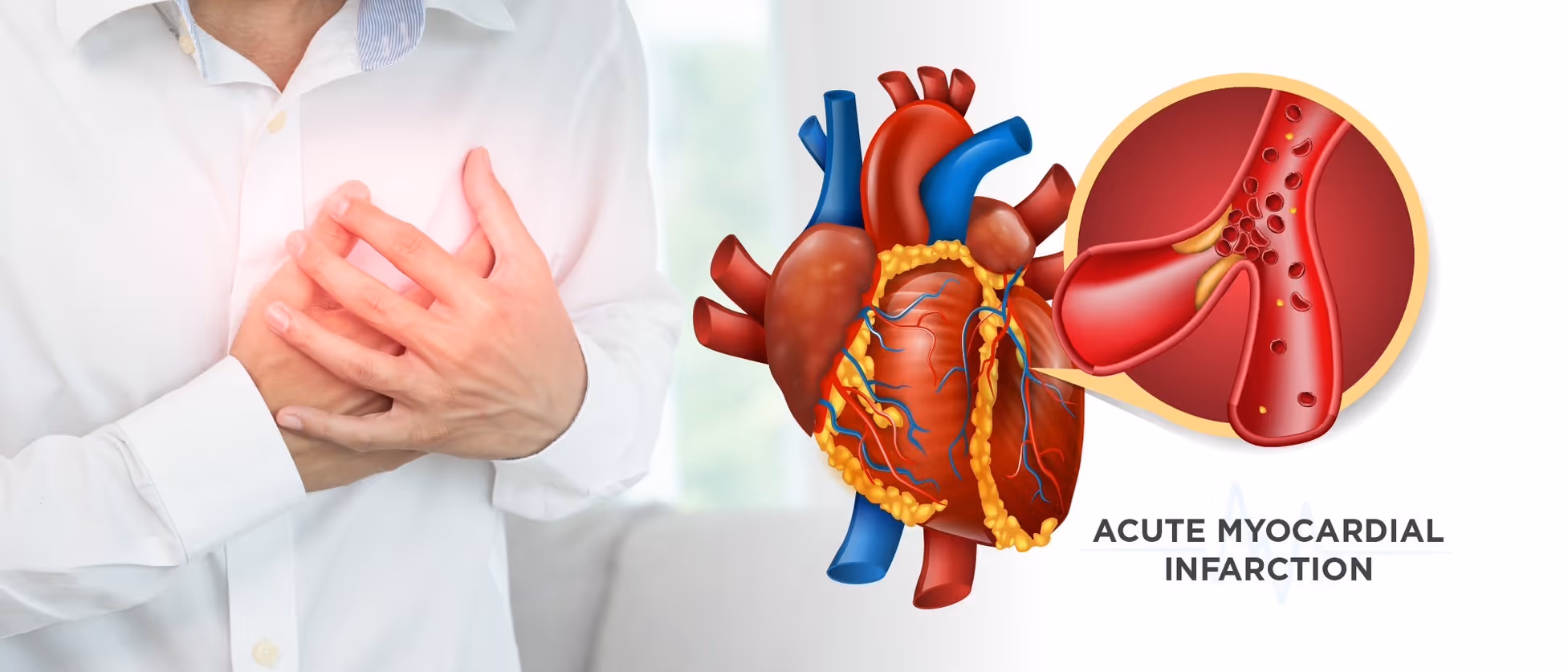 What conditions is ECMO used to treat?