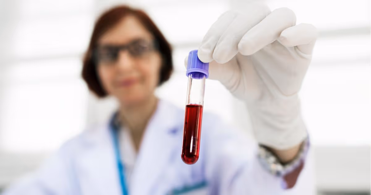 ตรวจ CBC ตรวจความสมบูรณ์ของเม็ดเลือด ค่าปกติ และการทดสอบ - Complete Blood Count : Normal Ranges and Test Details