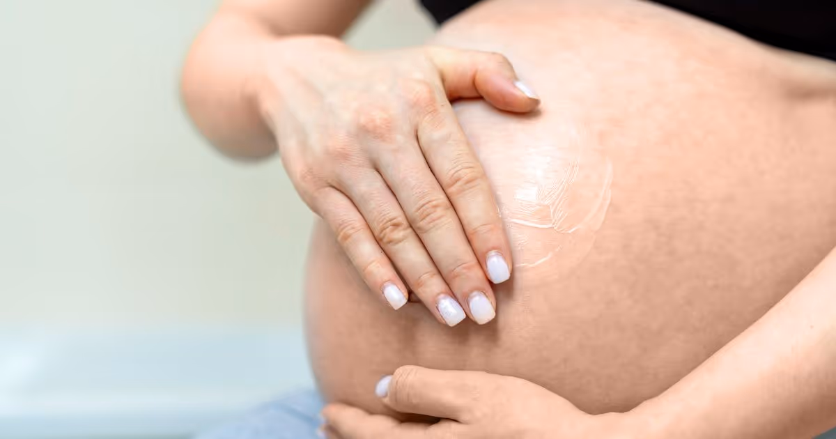 Stretch Marks (striae) Banner 3