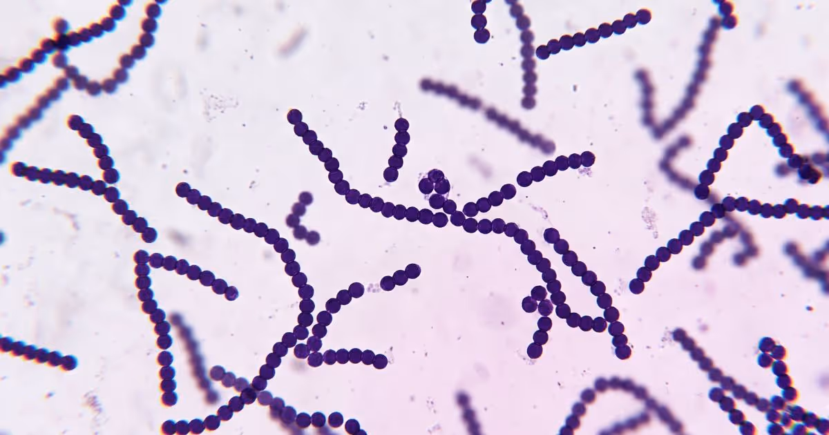 Microscopic simulation image of Streptococcus suis