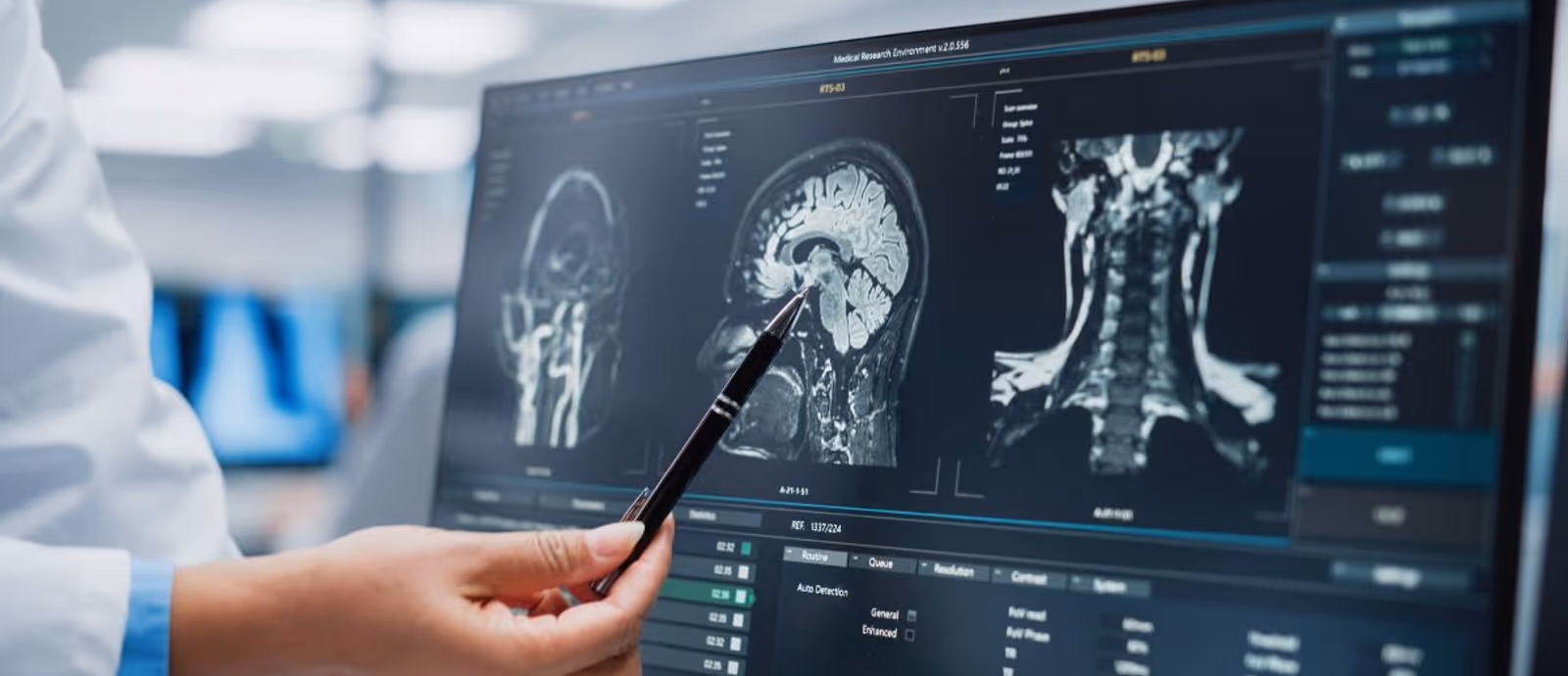 โรคมะเร็งสมอง (Brain Cancer) อาการ สาเหตุ การตรวจวินิจฉัยและการรักษา