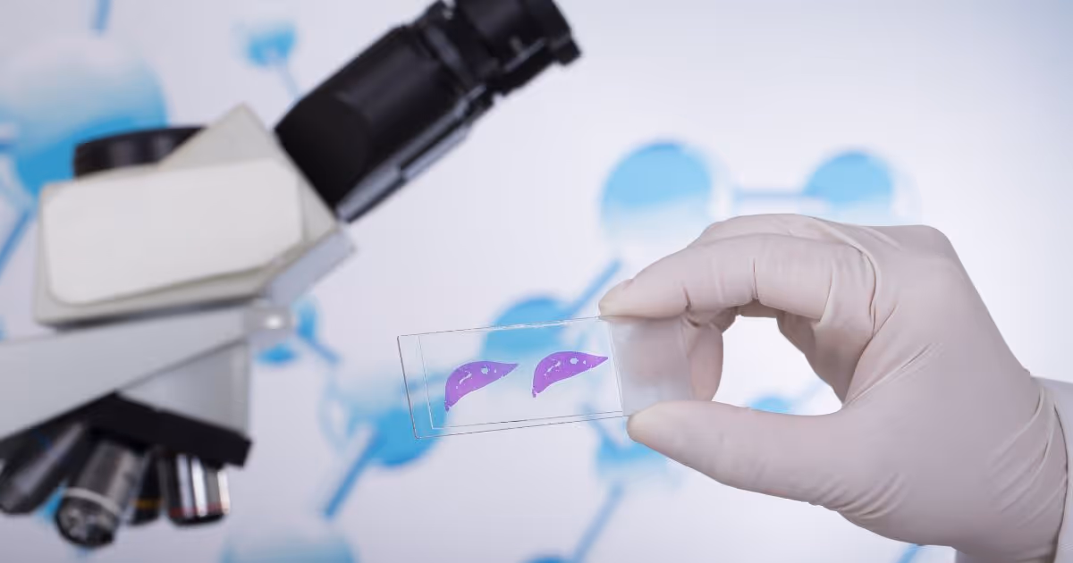 ขั้นตอนและผลตรวจการเจาะชิ้นเนื้อตับ - Liver Biopsy: Procedure, Rusults and After