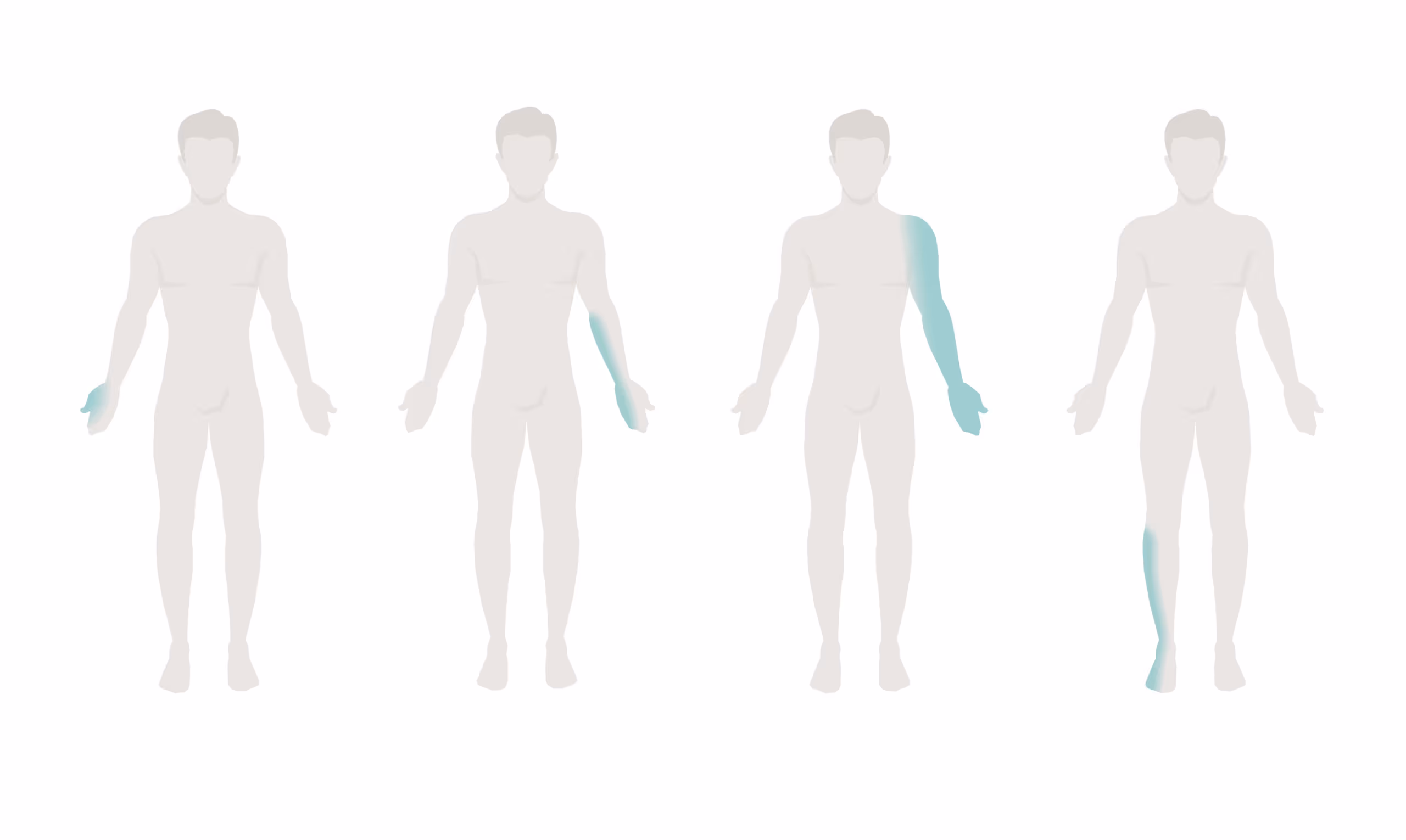 ผู้ป่วยที่มีอาการชาของแขนหรือขาข้างใดข้างหนึ่ง - Causes of peripheral neuropathy based on presenting symptoms