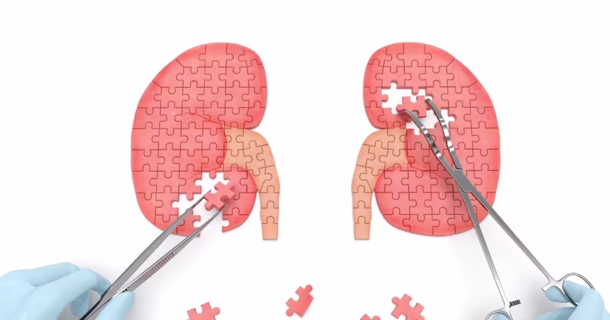 เนื้องอกที่ไต (Kidney Tumors) อาการ สาเหตุ การตรวจวินิจฉัยและการรักษา