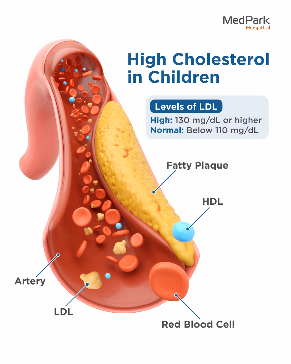 Cross-section illustration of an artery showing high cholesterol in children. Yellow fatty plaque builds up along one artery wall, narrowing the passage where red blood cells, LDL (yellow clusters), and HDL (blue spheres) flow. A callout box lists LDL levels: high is 130 mg/dL or higher, normal is below 110 mg/dL. MedPark Hospital infographic.