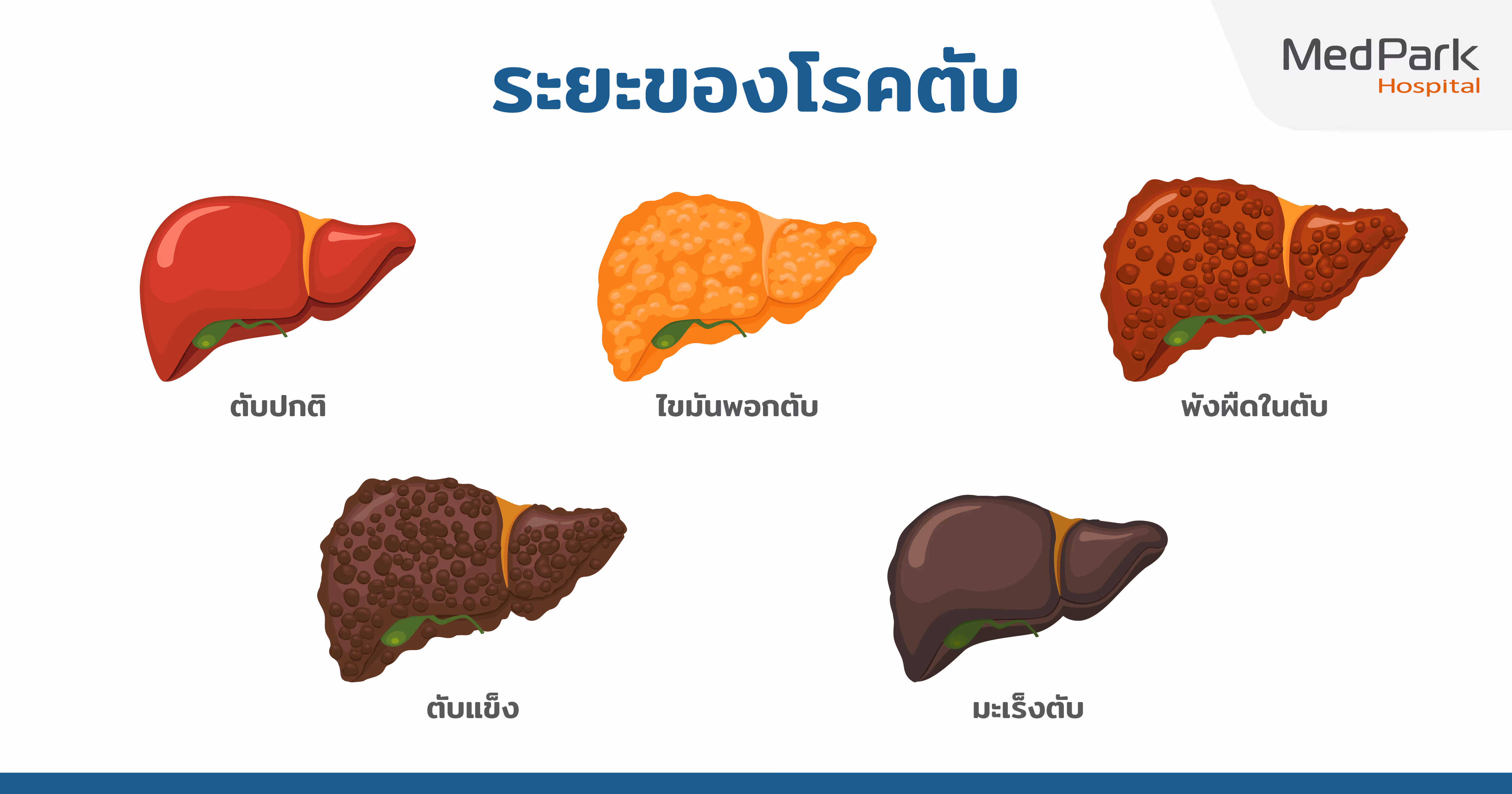 ผลการตรวจไฟโบรสแกน ไฟโบรสแกนค่าปกติ คือเท่าไหร่ FibroScan Results: What is a normal FibroScan score?