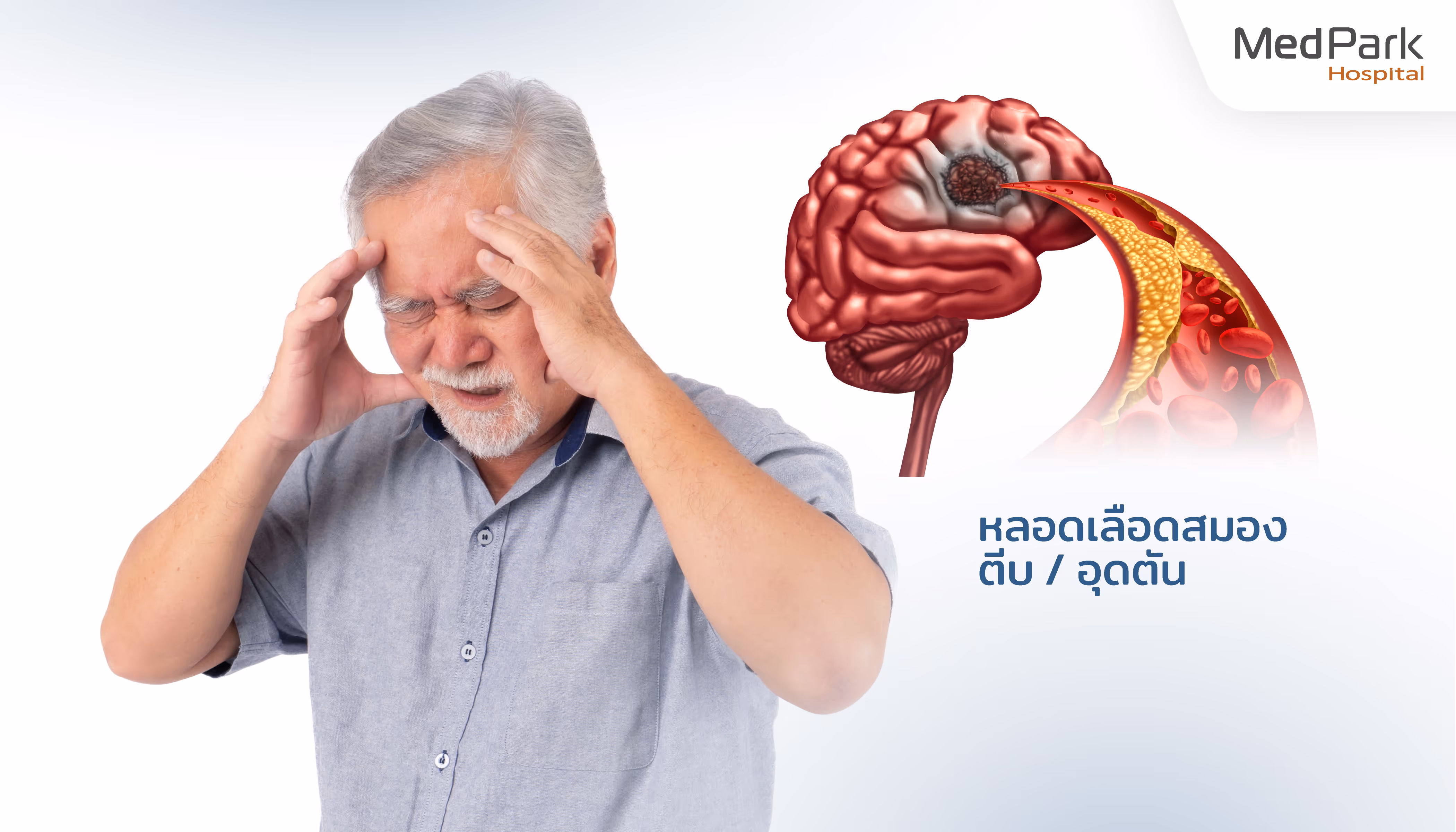 Cerebral Artery Stenosis Th