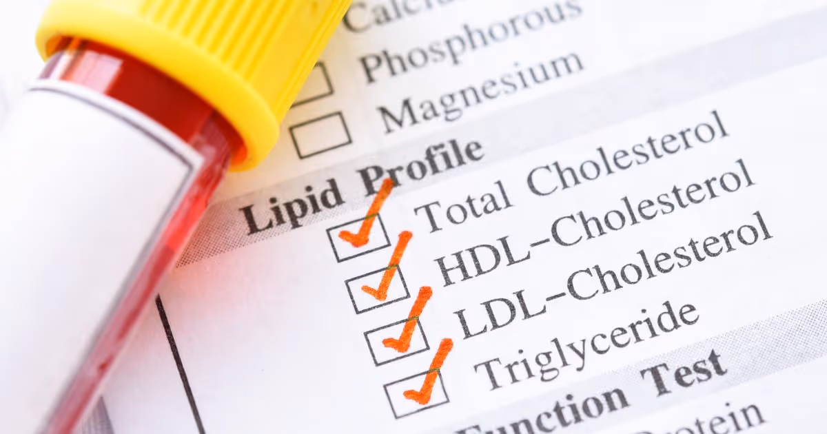 หลอดเก็บตัวอย่างเลือดวางบนแบบฟอร์มตรวจไขมันในเลือด (Lipid Profile) ซึ่งแสดงค่าคอเลสเตอรอลรวม HDL LDL และไตรกลีเซอไรด์ เพื่อประเมินภาวะคอเลสเตอรอลสูงและความเสี่ยงโรคหัวใจและหลอดเลือด