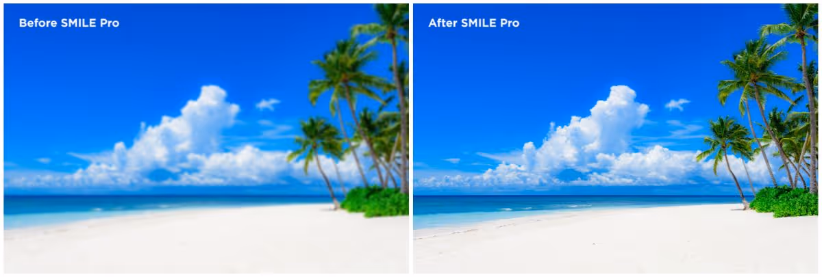 Before After  Re L Ex Smile Pro