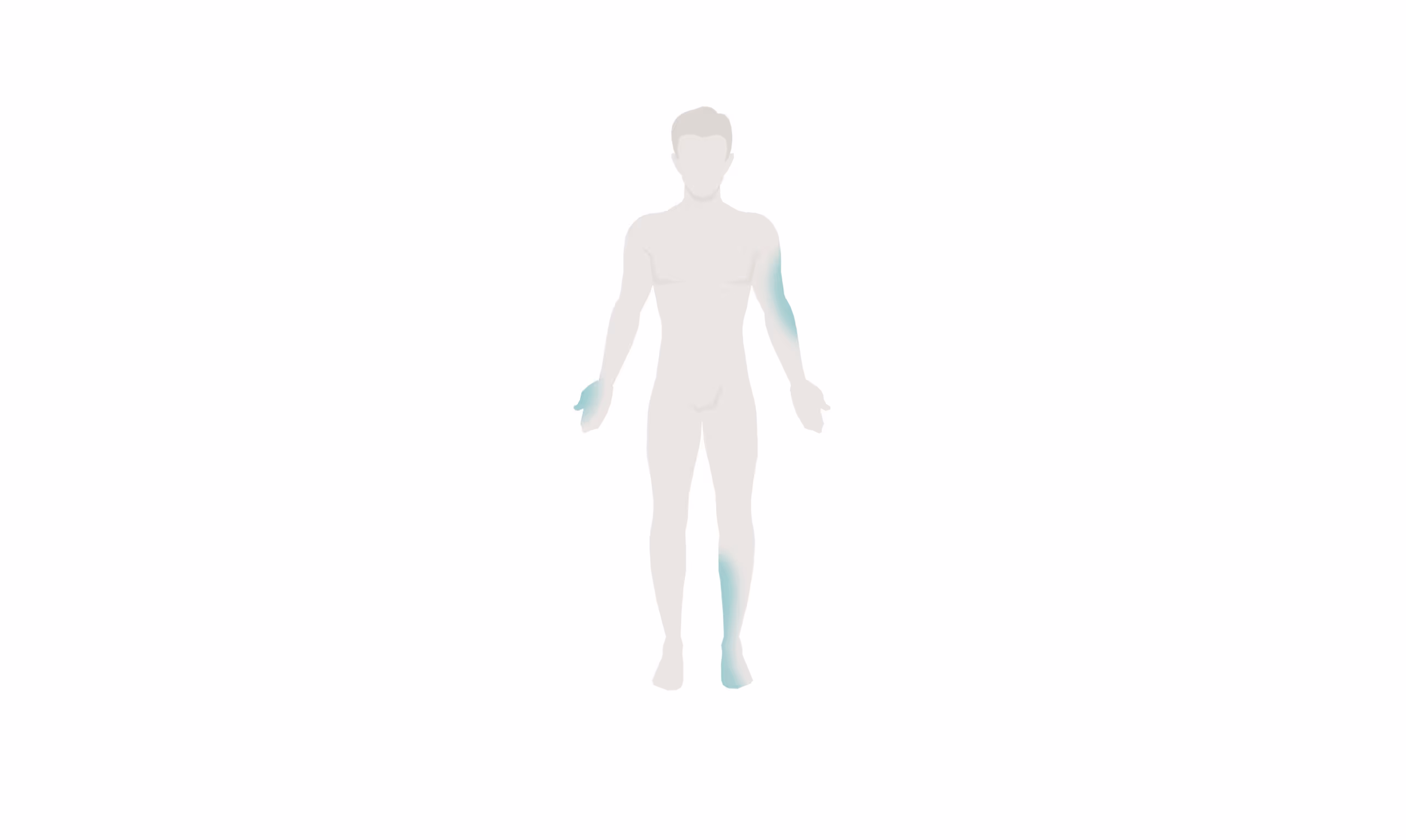 ผู้ป่วยที่มีอาการชาส่วนปลายของแขนและขาทั้งสองข้าง - Numbness on single arm or leg