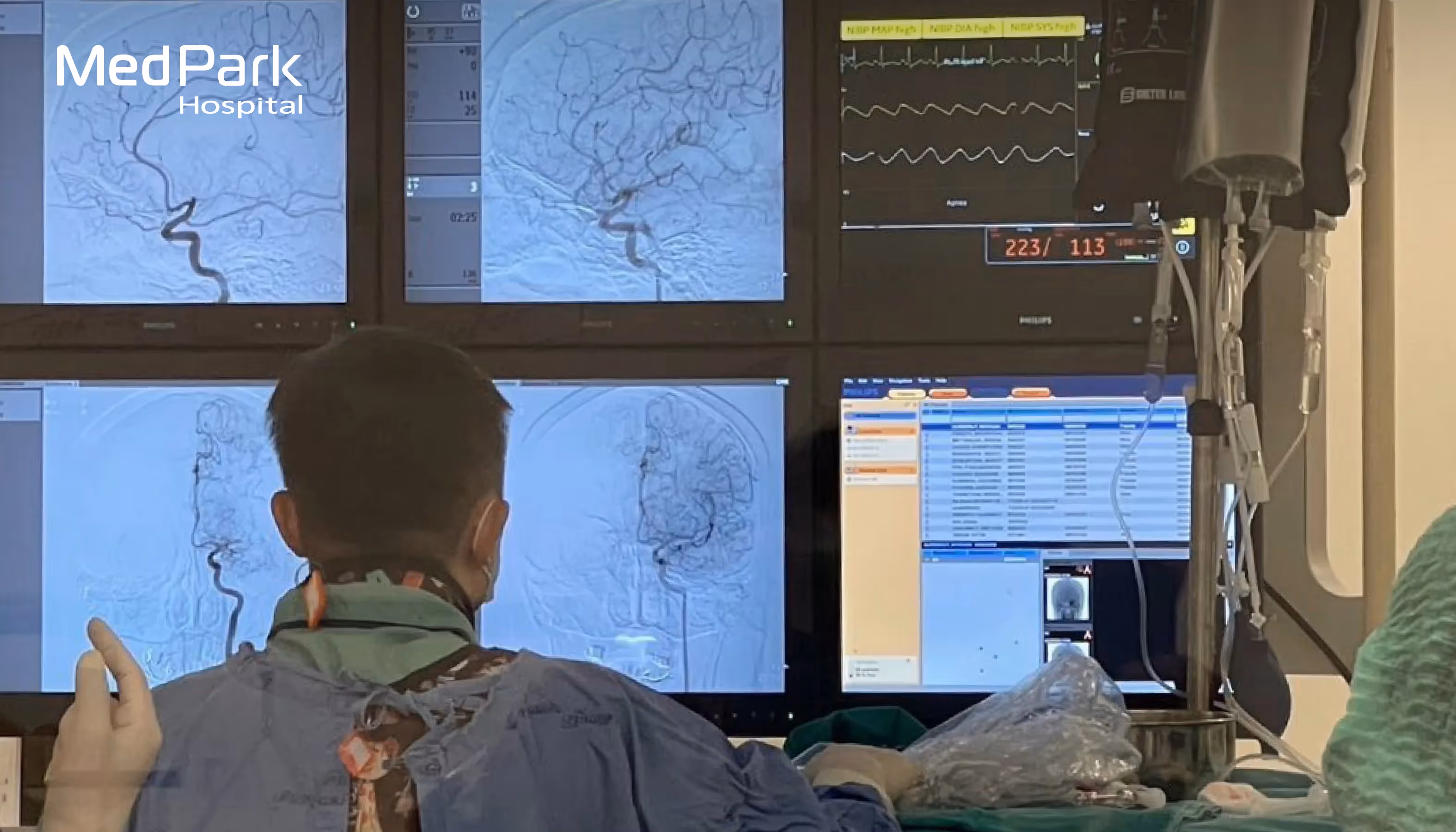 ขั้นตอนการตรวจหลอดเลือดสมอง - What is the cerebral angiogram procedure?