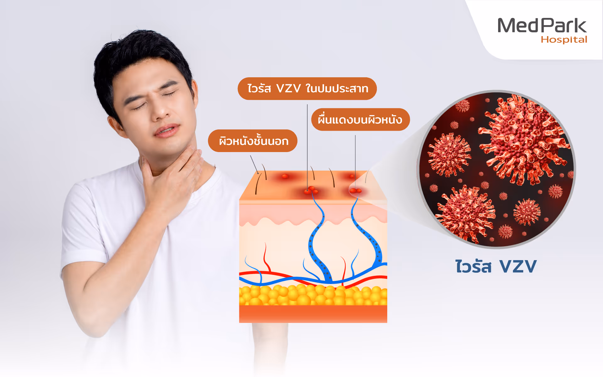 งูสวัดเกิดจากอะไร-what causes herpes zoster?