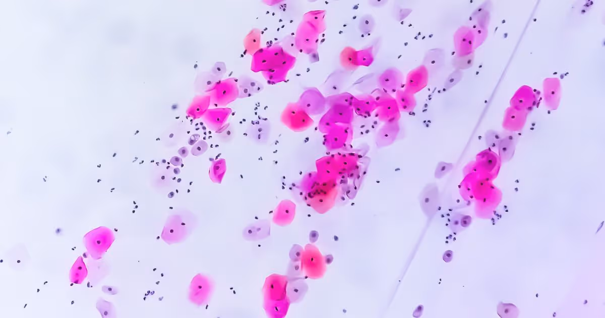 Photomicrograph of Paps smear