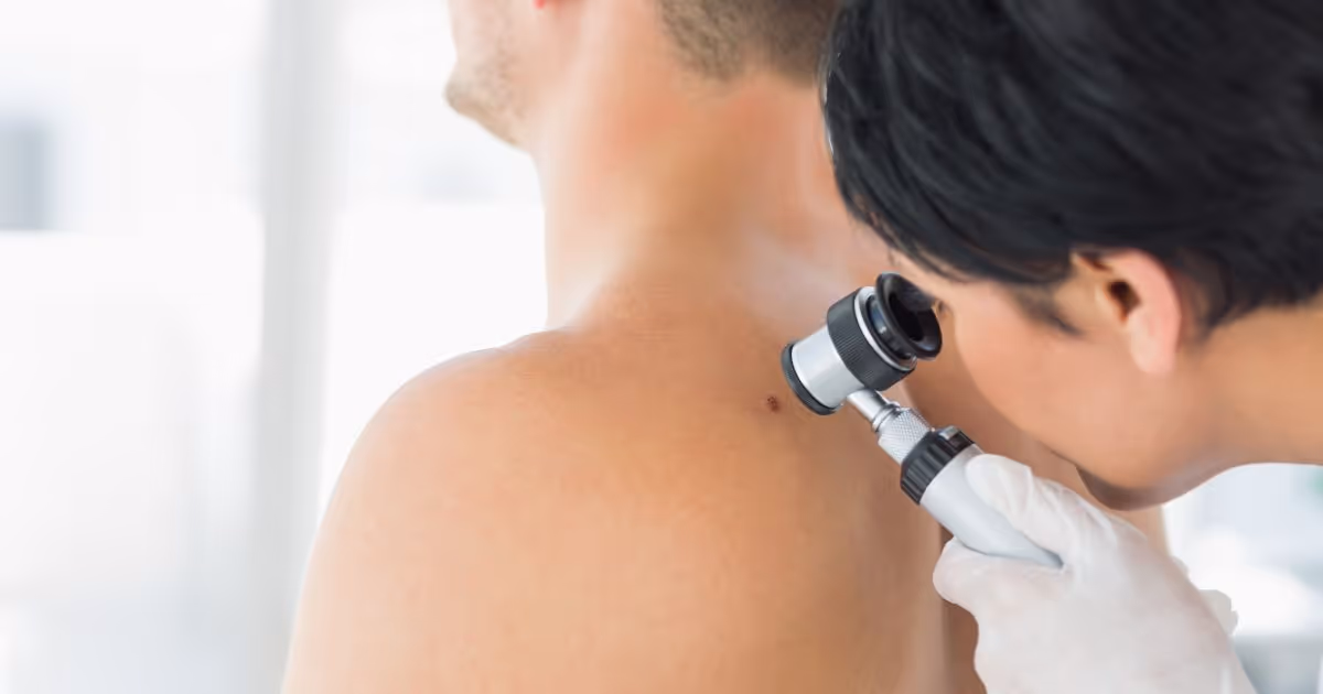 การวินิจฉัยมะเร็งผิวหนังก่อนการรักษาด้วยวิธี Mohs Surgery