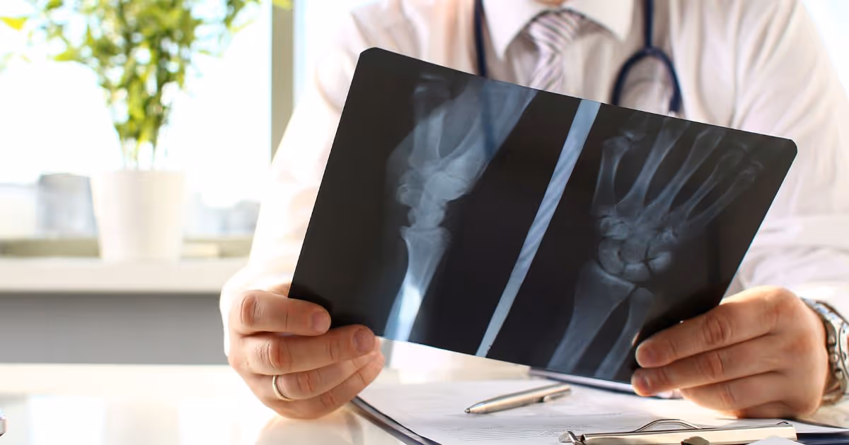 Severe, Complicated, Traumatic Bone Fracture Banner 2