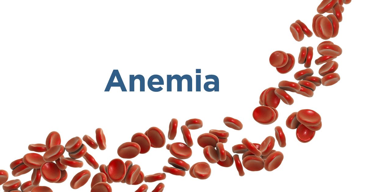 is glutathione good for anemia Anemia: Causes, Symptoms, Diagnosis, Treatments Container:Capsules Sulforaphane increases nuclear Nrf2 roomsium-selected