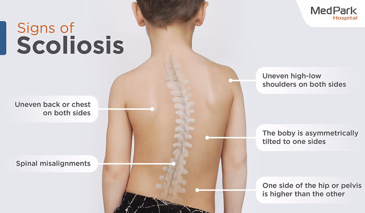 Scoliosis Surgery   En