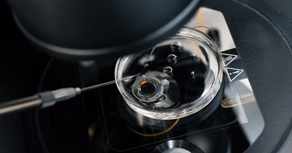ขั้นตอนการทำ ก่อนและหลังทำเด็กหลอดแก้ว (IVF - In Vitro Fertilization)