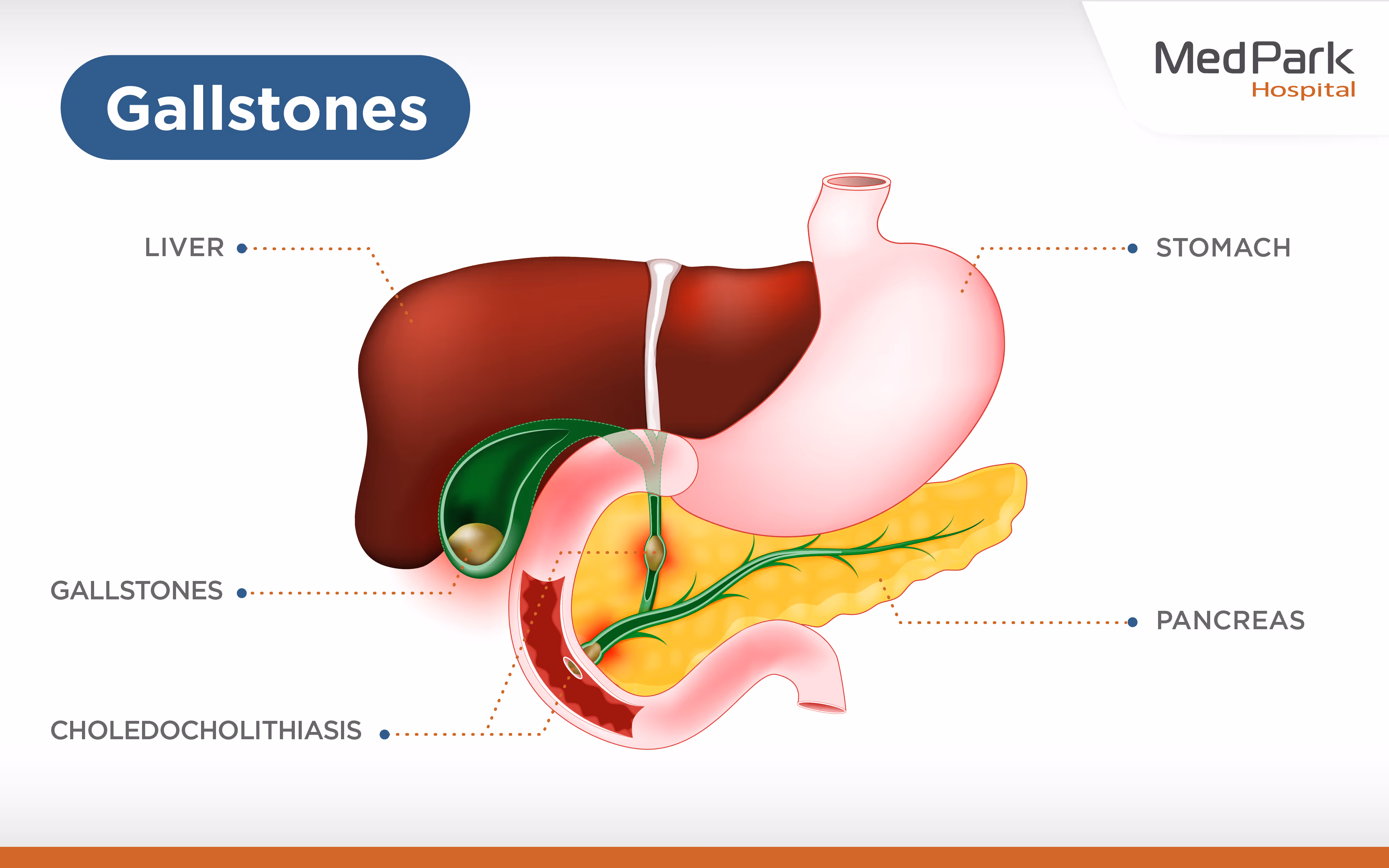 Binary tract and pancreatic diseases can be treated with laparoscopic cholecystectomy