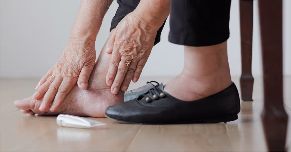 การดูแลเท้าและเล็บเท้าในคนไข้เบาหวาน (Diabetic Podiatry)