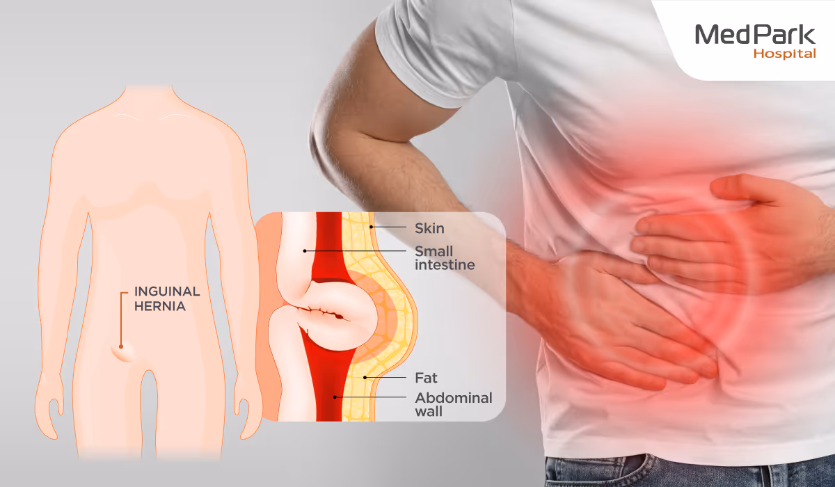 Aw Laparoscopic Herniorrhaphy 1 En