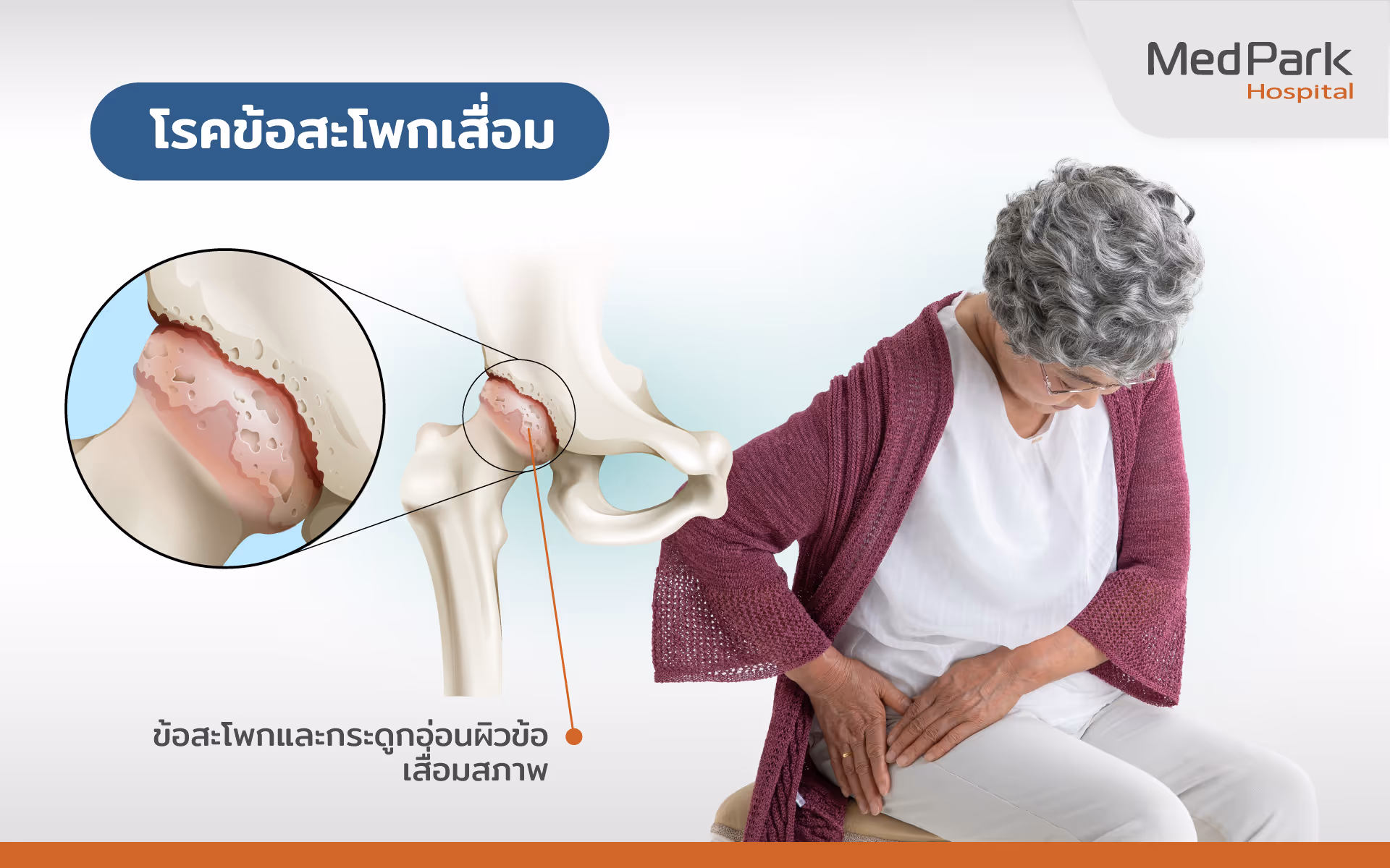 Hip Replacement 2 Th