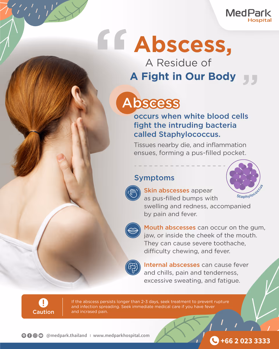 Abscess - Types, Symptoms, Causes & Treatment